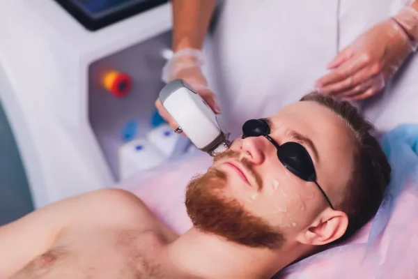 Erkek Lazer Epilasyon