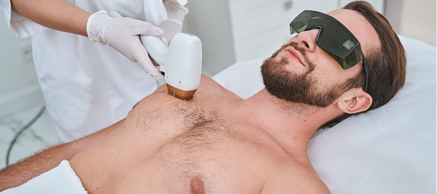 Erkek Lazer Epilasyon