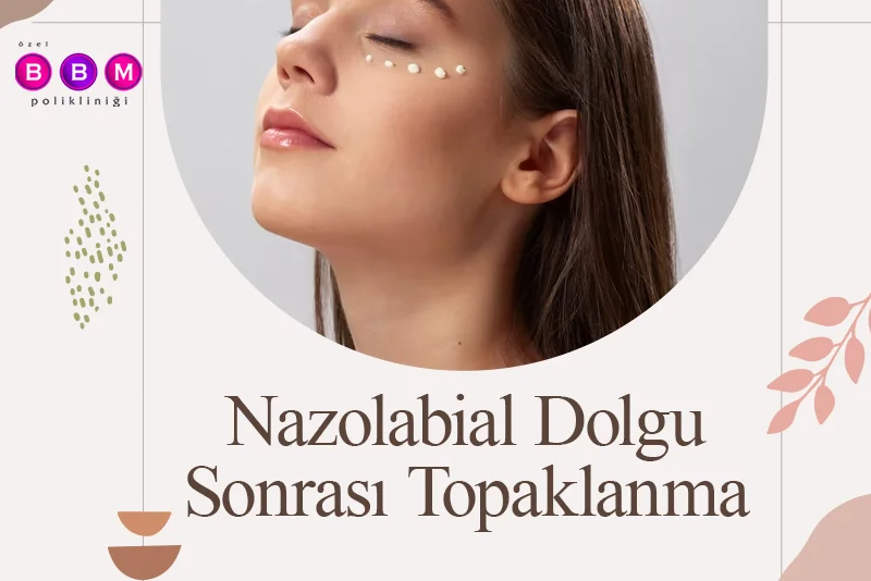 Nazolabial Dolgu Sonrası Topaklanma
