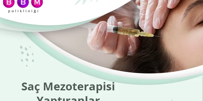Saç Mezoterapisi Yaptıranlar