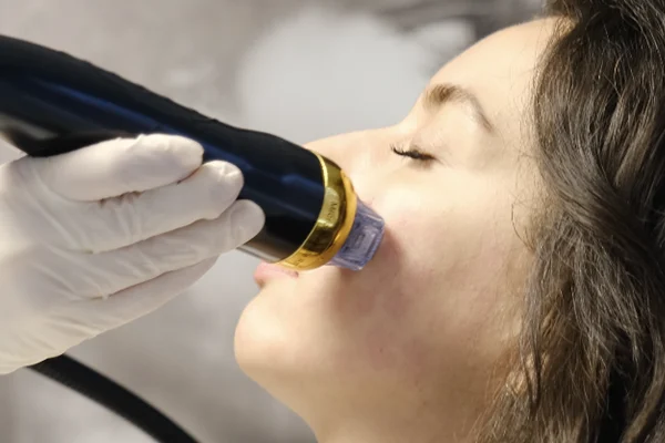 Altın İğne Yüz Gençleştirme