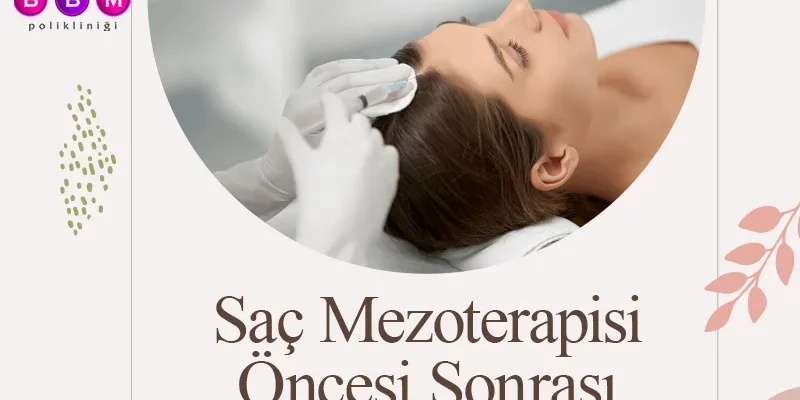 Saç Mezoterapisi Öncesi Sonrası