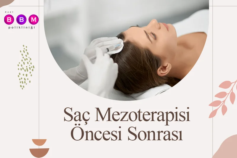 Saç Mezoterapisi Öncesi Sonrası