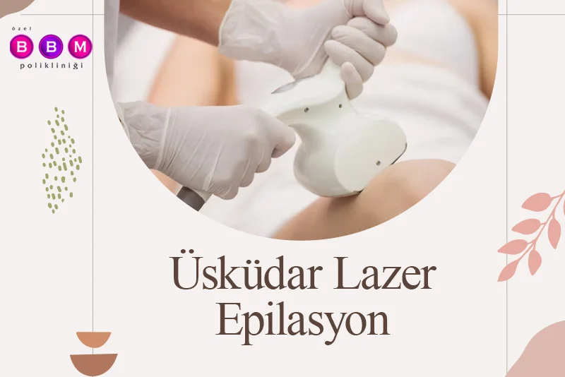 Üsküdar Lazer Epilasyon
