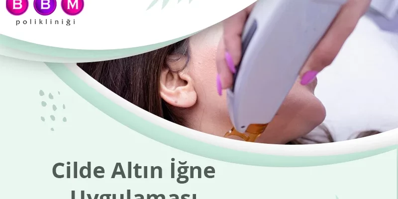Cilde Altın İğne Uygulaması