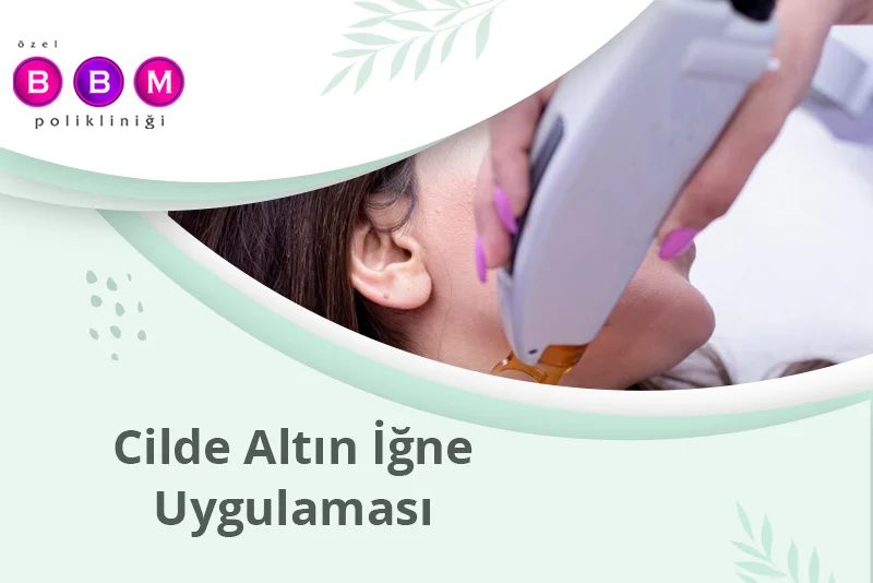 Cilde Altın İğne Uygulaması