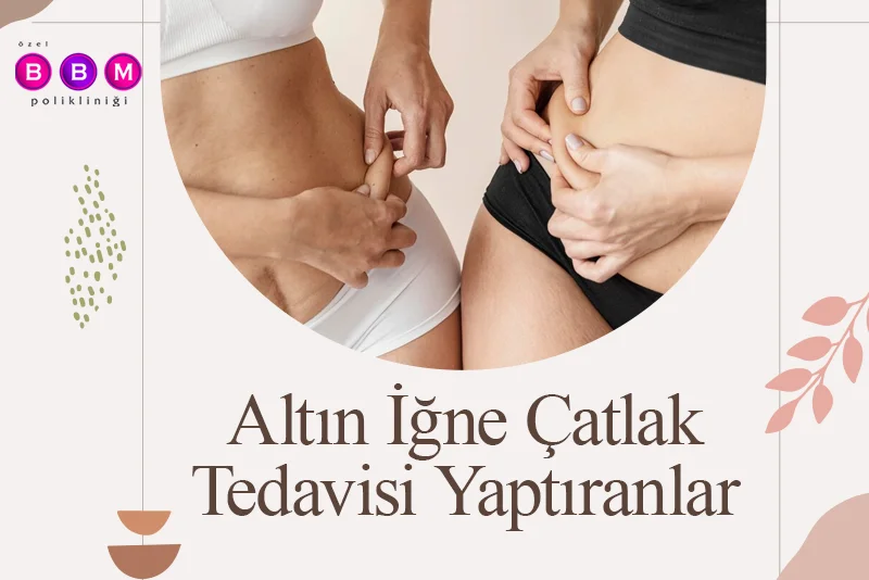 Altın İğne Çatlak Tedavisi Yaptıranlar