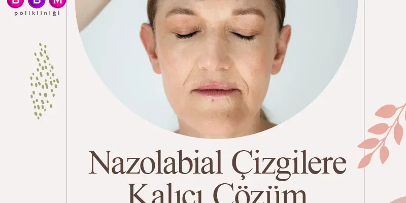 Nazolabial Çizgilere Kalıcı Çözüm