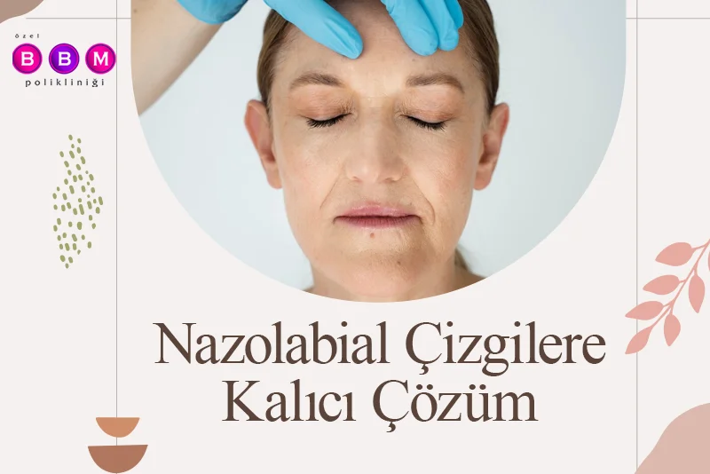 Nazolabial Çizgilere Kalıcı Çözüm