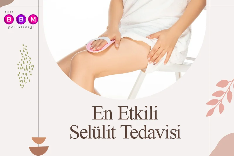 En Etkili Selülit Tedavisi