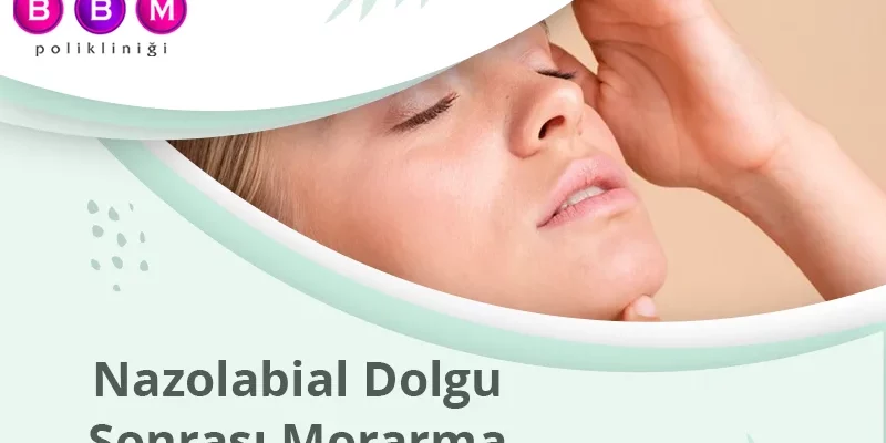 Nazolabial Dolgu Sonrası Morarma