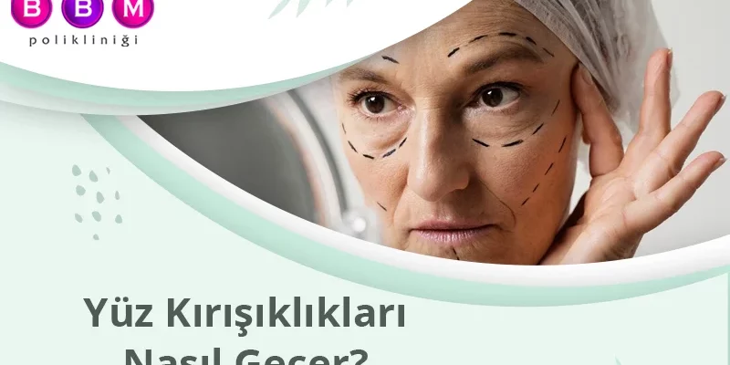 Yüz Kırışıklıkları Nasıl Geçer?