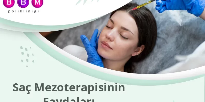 Saç Mezoterapisinin Faydaları