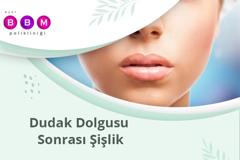 Dudak Dolgusu Sonrası Şişlik