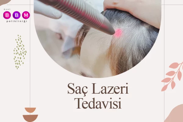 Saç Lazeri Tedavisi