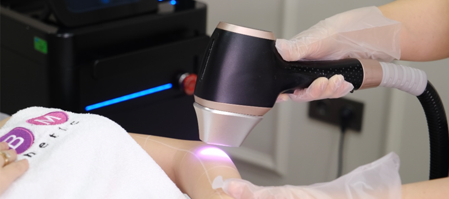 Nd:YAG Lazer Epilasyon