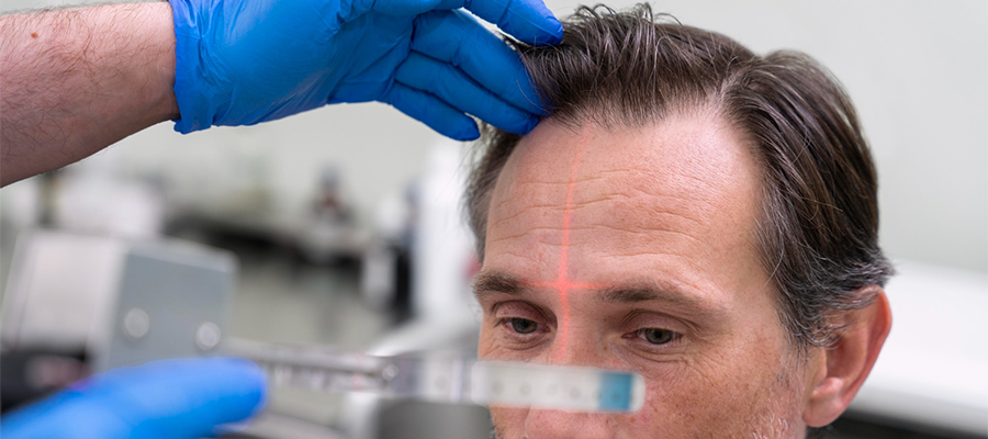 Safir FUE Saç Ekimi