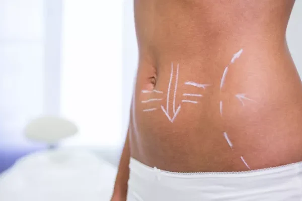 Enzimatik Lipoliz Uygulamaları